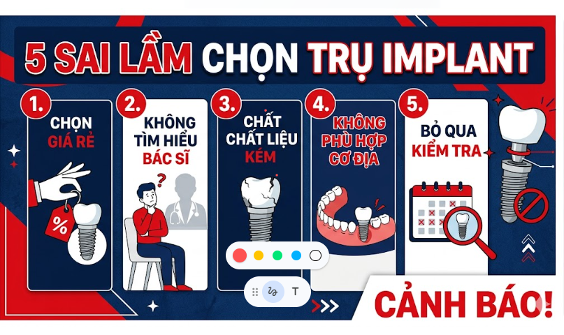 5 sai lầm khi chọn trụ Implant khiến tiền mất tật mang